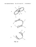 METHOD FOR CLOSING AN APERTURE IN A PATIENT S BODY diagram and image