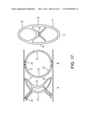 METHOD FOR CLOSING AN APERTURE IN A PATIENT S BODY diagram and image