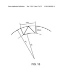 METHOD FOR CLOSING AN APERTURE IN A PATIENT S BODY diagram and image