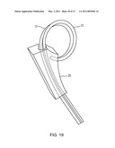 METHOD FOR CLOSING AN APERTURE IN A PATIENT S BODY diagram and image