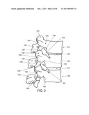 DEVICES AND METHODS FOR ARCHED ROOF CUTTERS diagram and image