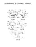 DEVICES AND METHODS FOR ARCHED ROOF CUTTERS diagram and image