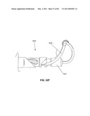 DEVICES AND METHODS FOR ARCHED ROOF CUTTERS diagram and image