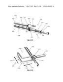 DEVICES AND METHODS FOR ARCHED ROOF CUTTERS diagram and image