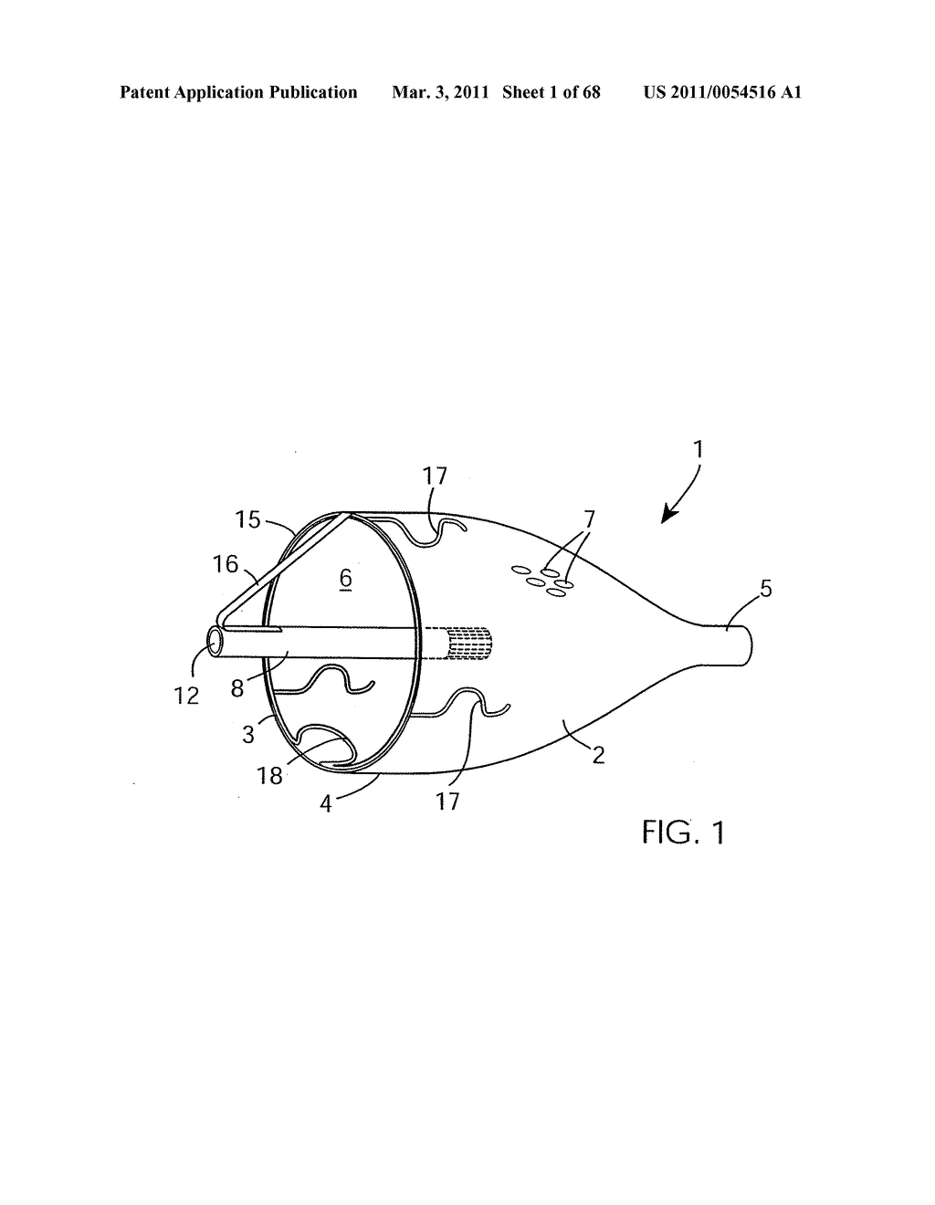 EMBOLIC PROTECTION METHOD - diagram, schematic, and image 02