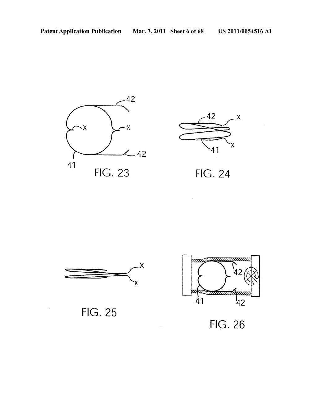 EMBOLIC PROTECTION METHOD - diagram, schematic, and image 07