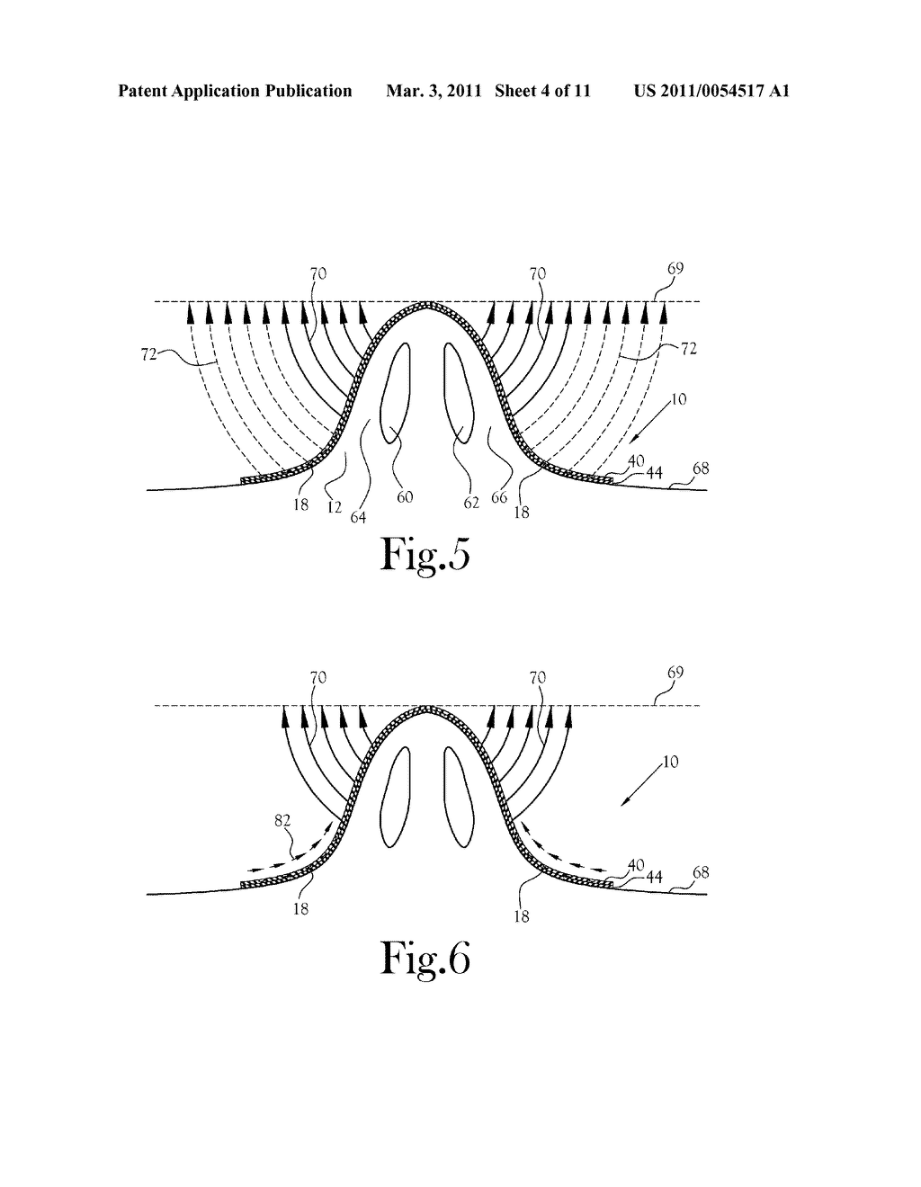 EXTERNAL NASAL DILATOR AND METHODS OF MANUFACTURE - diagram, schematic, and image 05