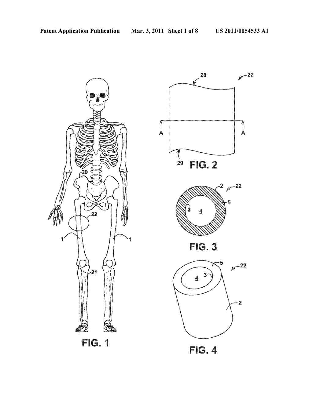 SPINOUS FUSION DEVICE - diagram, schematic, and image 02