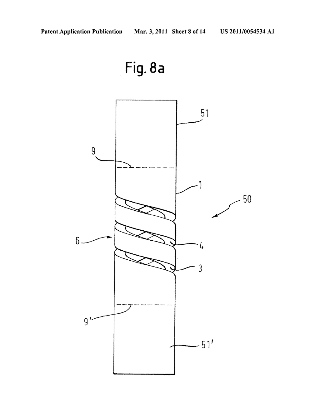 ELASTIC ELEMENT FOR THE USE IN A STABILIZATION DEVICE FOR BONES AND VERTEBRAE AND METHOD FOR THE MANUFACTURE OF SUCH ELASTIC ELEMENT - diagram, schematic, and image 09