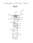 ELASTIC ELEMENT FOR THE USE IN A STABILIZATION DEVICE FOR BONES AND VERTEBRAE AND METHOD FOR THE MANUFACTURE OF SUCH ELASTIC ELEMENT diagram and image