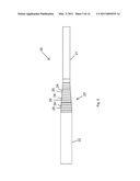 Size Transition Spinal Rod diagram and image