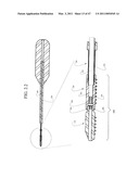 DISTAL INTERPHALANGEAL FUSION DEVICE AND METHOD OF USE diagram and image