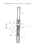 DISTAL INTERPHALANGEAL FUSION DEVICE AND METHOD OF USE diagram and image