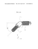 DISTAL INTERPHALANGEAL FUSION DEVICE AND METHOD OF USE diagram and image