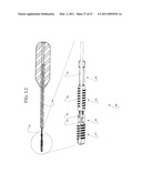 DISTAL INTERPHALANGEAL FUSION DEVICE AND METHOD OF USE diagram and image