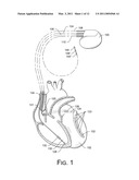 PACING, SENSING AND OTHER PARAMETER MAPS BASED ON LOCALIZATION SYSTEM DATA diagram and image