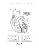 PACING, SENSING AND OTHER PARAMETER MAPS BASED ON LOCALIZATION SYSTEM DATA diagram and image