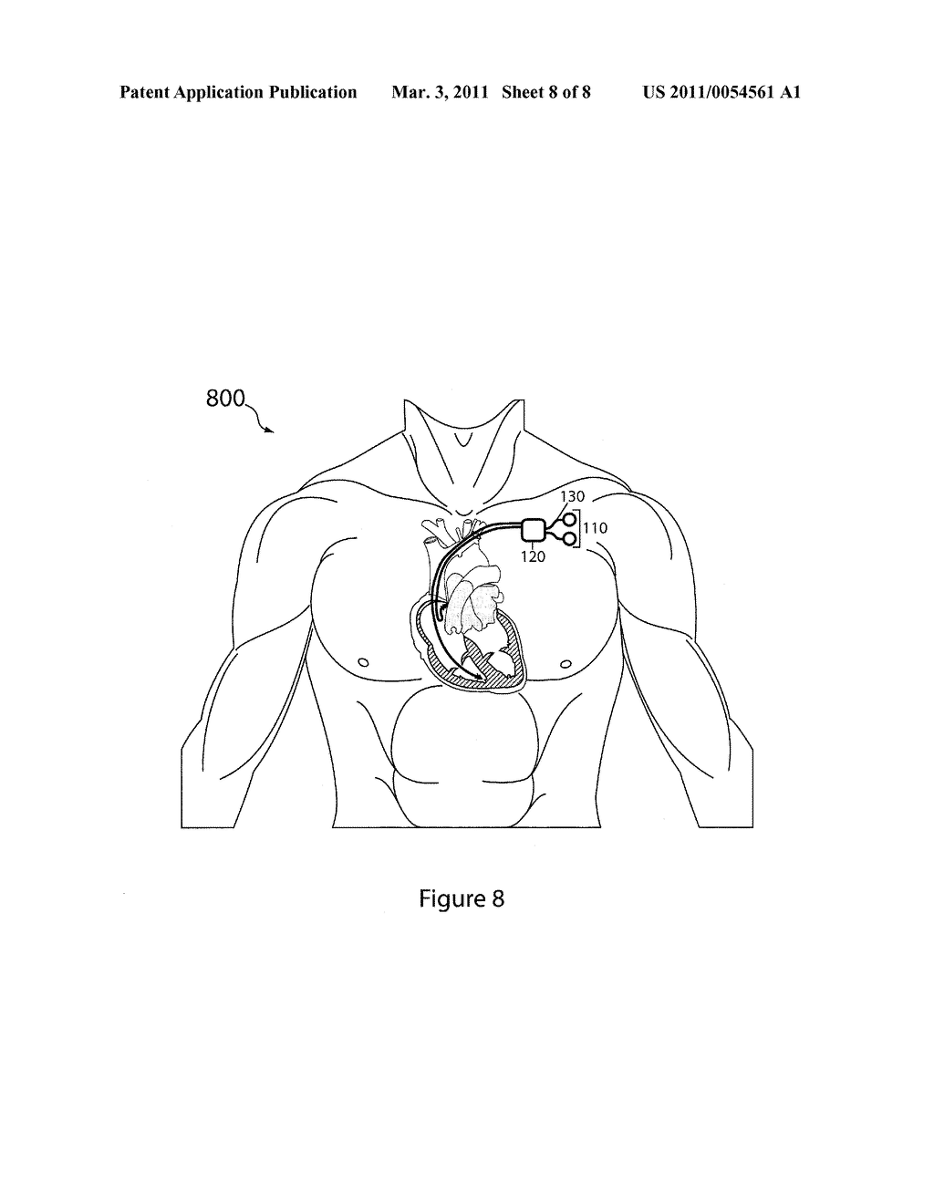 IMPLANTABLE ELECTRODE ASSEMBLY, IMPLANTABLE ELECTROCHEMICAL POWER CELLS AND IMPLANTABLE MEDICAL DEVICE ASSEMBLIES - diagram, schematic, and image 09