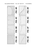 VASCULAR GRAFTS DERIVED FROM ACELLULAR TISSUE MATRICES diagram and image