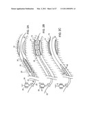 IMPLANTABLE MEDICAL DEVICES diagram and image