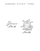 ACCOMMODATING INTRAOCULAR LENS WITH OUTER SUPPORT STRUCTURE diagram and image