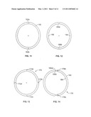 ACCOMMODATING INTRAOCULAR LENS WITH OUTER SUPPORT STRUCTURE diagram and image