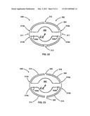 ACCOMMODATING INTRAOCULAR LENS WITH OUTER SUPPORT STRUCTURE diagram and image