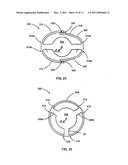 ACCOMMODATING INTRAOCULAR LENS WITH OUTER SUPPORT STRUCTURE diagram and image