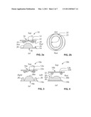 INTERVERTEBRAL DISC PROSTHESIS HAVING BALL AND RING STRUCTURE diagram and image