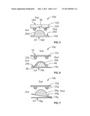 INTERVERTEBRAL DISC PROSTHESIS HAVING BALL AND RING STRUCTURE diagram and image