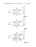 INTERVERTEBRAL DISC PROSTHESIS HAVING BALL AND RING STRUCTURE diagram and image