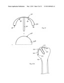 HUMERAL JOINT REPLACEMENT COMPONENT diagram and image