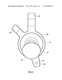 REFLEX FIXATION GEOMETRY REVISION AND RECONSTRUCTION SYSTEM REVERSE ARTICULATION diagram and image