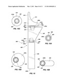 REFLEX FIXATION GEOMETRY REVISION AND RECONSTRUCTION SYSTEM REVERSE ARTICULATION diagram and image