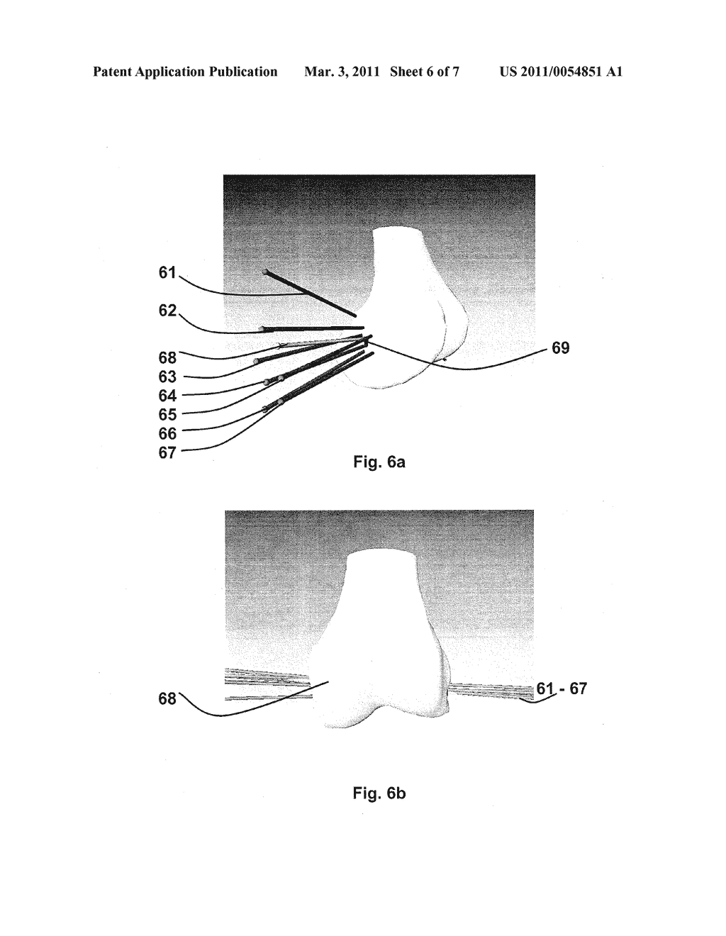 METHOD FOR DETECTING INFORMATION RELEVANT FOR THE CHARACTERIZATION OF JOINT MOVEMENTS - diagram, schematic, and image 07