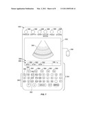 SYSTEM AND METHOD FOR REDUCING ULTRASOUND INFORMATION STORAGE REQUIREMENTS diagram and image