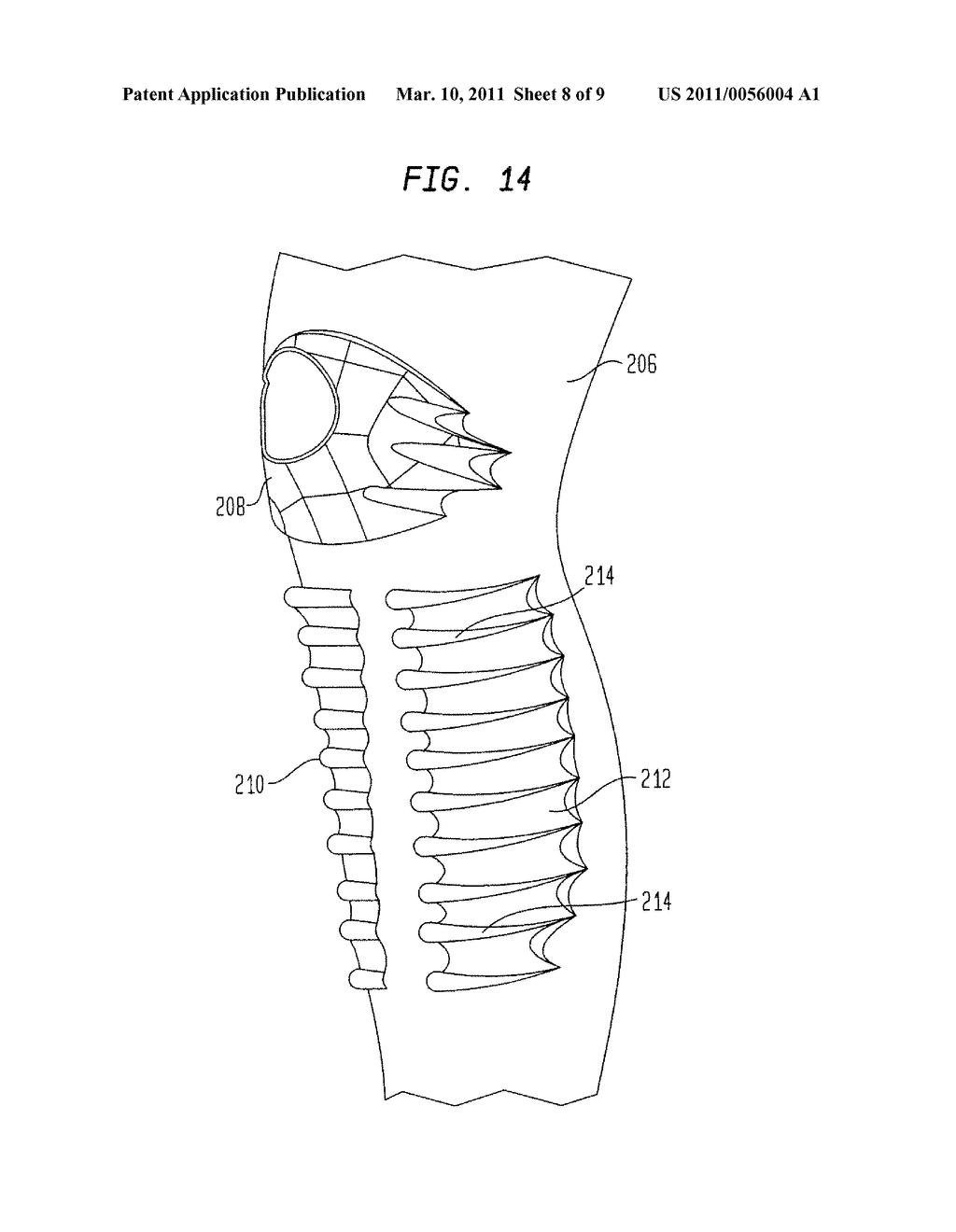 Protective anatomical pads and methods of making - diagram, schematic, and image 09