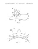 FOREHEAD PAD FOR RESPIRATORY MASK diagram and image