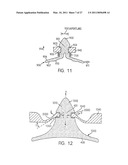 FOREHEAD PAD FOR RESPIRATORY MASK diagram and image