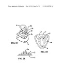 Tie-Down Anchor System and Method diagram and image