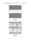 Polymer Blend-Bioceramic Composite Implantable Medical Devices diagram and image