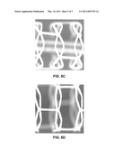 Polymer Blend-Bioceramic Composite Implantable Medical Devices diagram and image