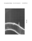 Setting Laser Power For Laser Machining Stents From Polymer Tubing diagram and image