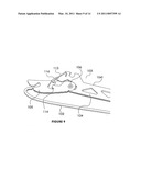 SKATE STRIP-BLADE HOLDER diagram and image