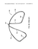 Collapsible structures having enhancements diagram and image