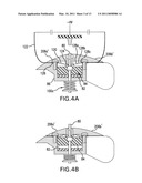 EXTENDABLE ELECTRODE FOR GAS DISCHARGE LASER diagram and image