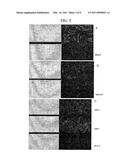 CELLULAR THERAPEUTIC AGENT FOR INCONTINENCE OR URINE COMPRISING STEM CELLS ORIGINATED FROM DECIDUA OR ADIPOSE diagram and image