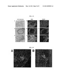 CELLULAR THERAPEUTIC AGENT FOR INCONTINENCE OR URINE COMPRISING STEM CELLS ORIGINATED FROM DECIDUA OR ADIPOSE diagram and image