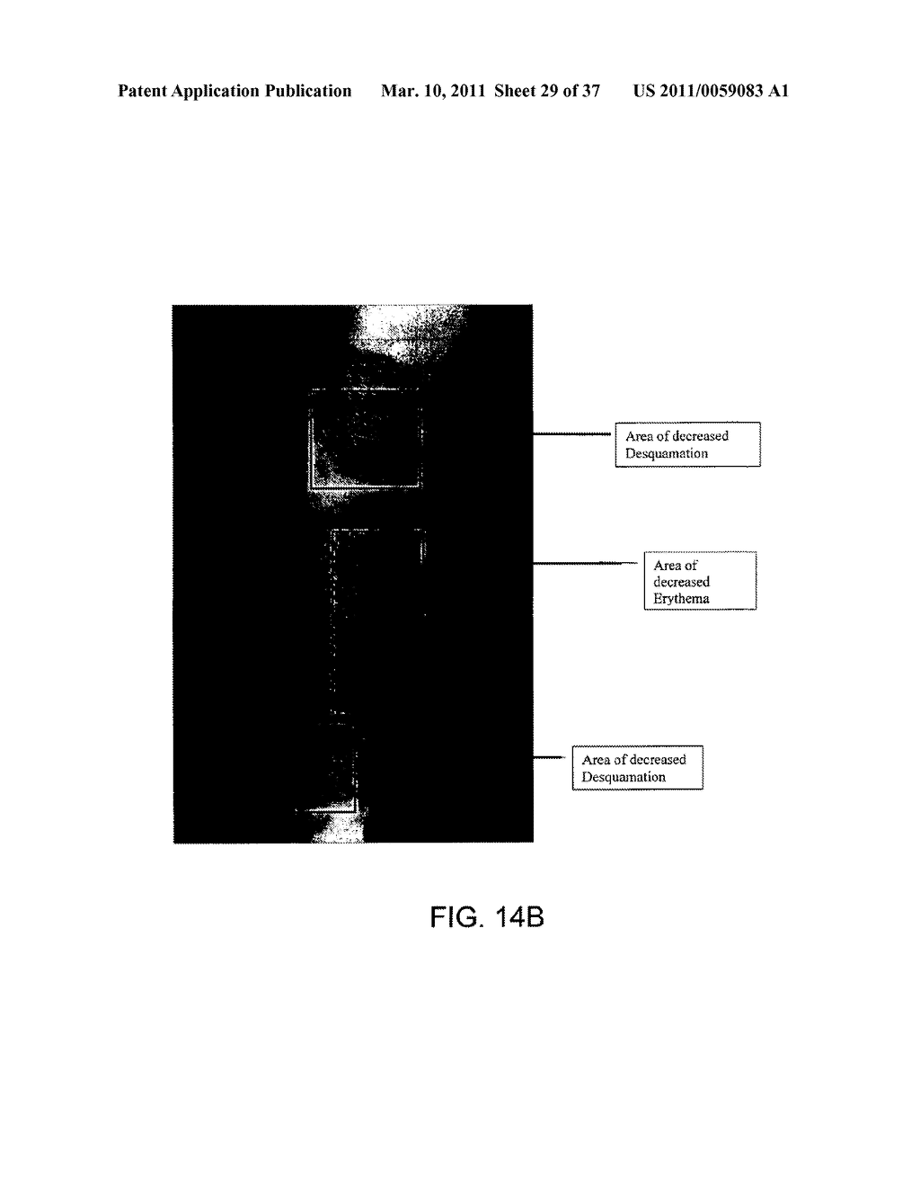 AGENT FOR TREATING DISEASE - diagram, schematic, and image 30