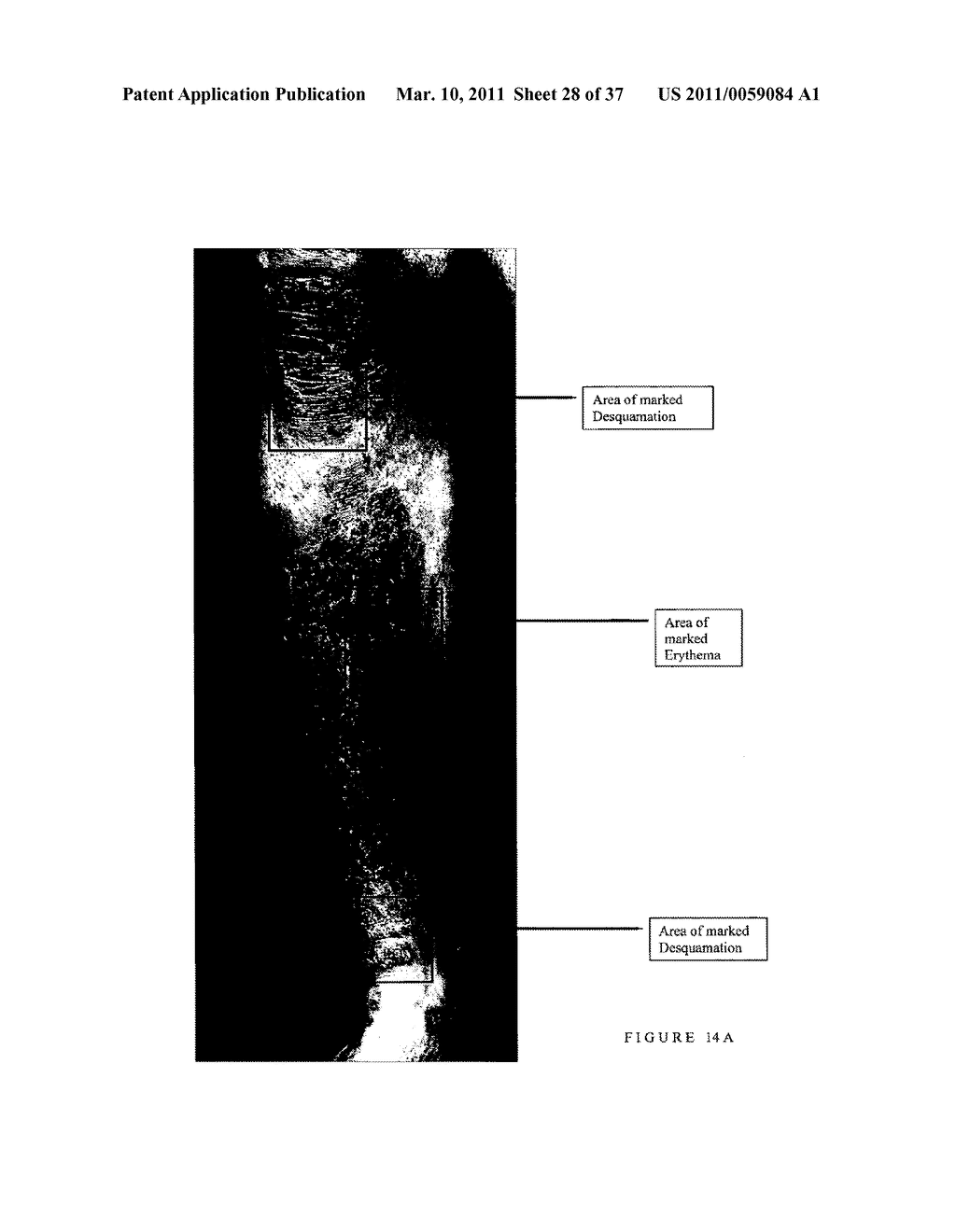 AGENT FOR TREATING DISEASE - diagram, schematic, and image 29